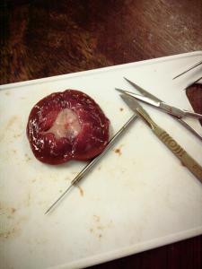 Kidney Dissection